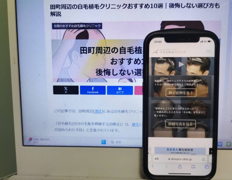 田町周辺の自毛植毛クリニックおすすめ10選｜後悔しない選び方も解説