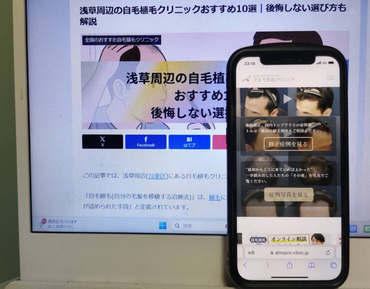 浅草周辺の自毛植毛クリニックおすすめ10選｜後悔しない選び方も解説
