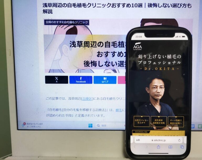 浅草周辺の自毛植毛クリニックおすすめ10選｜後悔しない選び方も解説