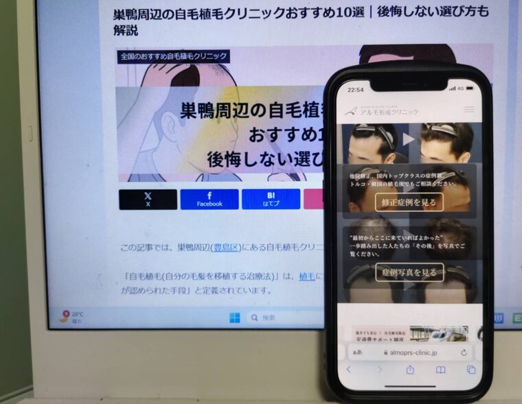 巣鴨周辺の自毛植毛クリニックおすすめ10選｜後悔しない選び方も解説