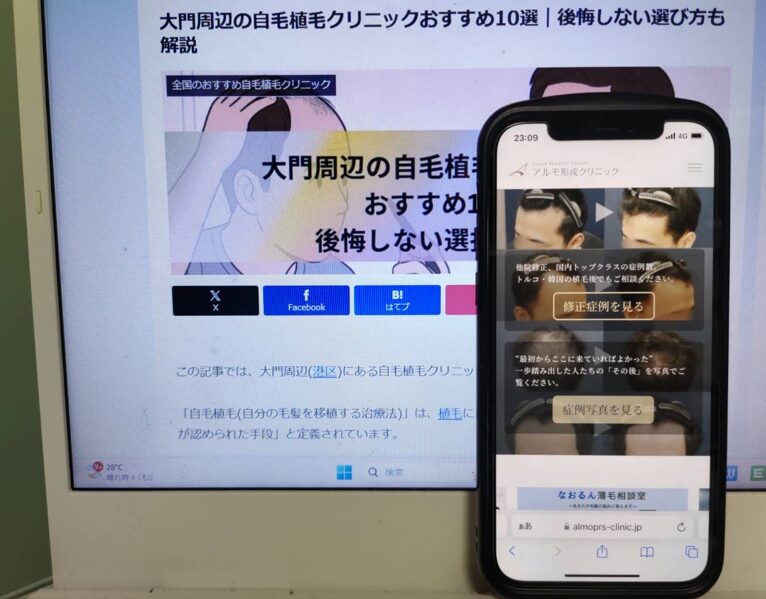大門周辺の自毛植毛クリニックおすすめ10選｜後悔しない選び方も解説