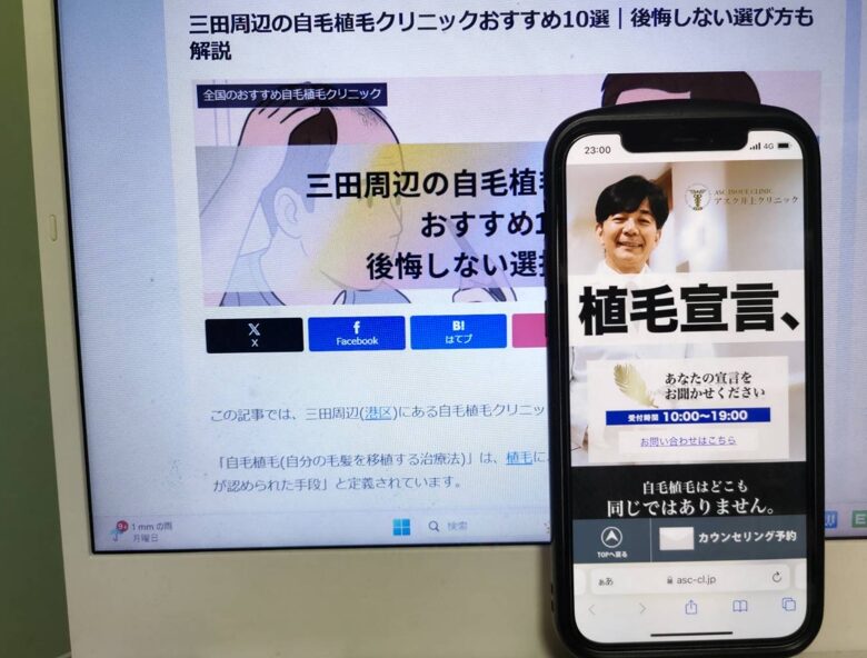 三田周辺の自毛植毛クリニックおすすめ10選｜後悔しない選び方も解説