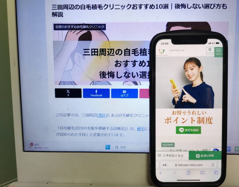 三田周辺の自毛植毛クリニックおすすめ10選｜後悔しない選び方も解説