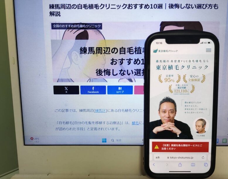 練馬周辺の自毛植毛クリニックおすすめ10選｜後悔しない選び方も解説