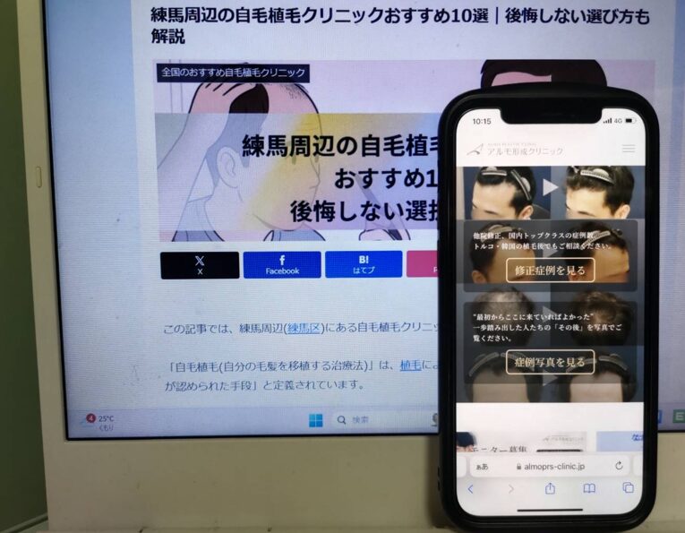 練馬周辺の自毛植毛クリニックおすすめ10選｜後悔しない選び方も解説