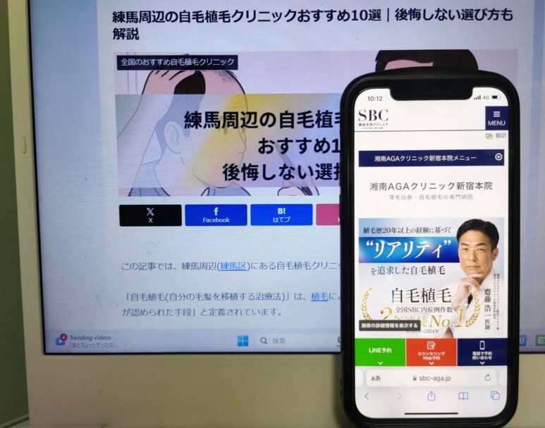 練馬周辺の自毛植毛クリニックおすすめ10選｜後悔しない選び方も解説