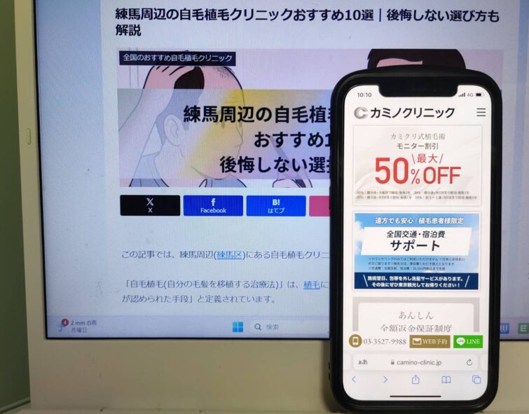 練馬周辺の自毛植毛クリニックおすすめ10選｜後悔しない選び方も解説