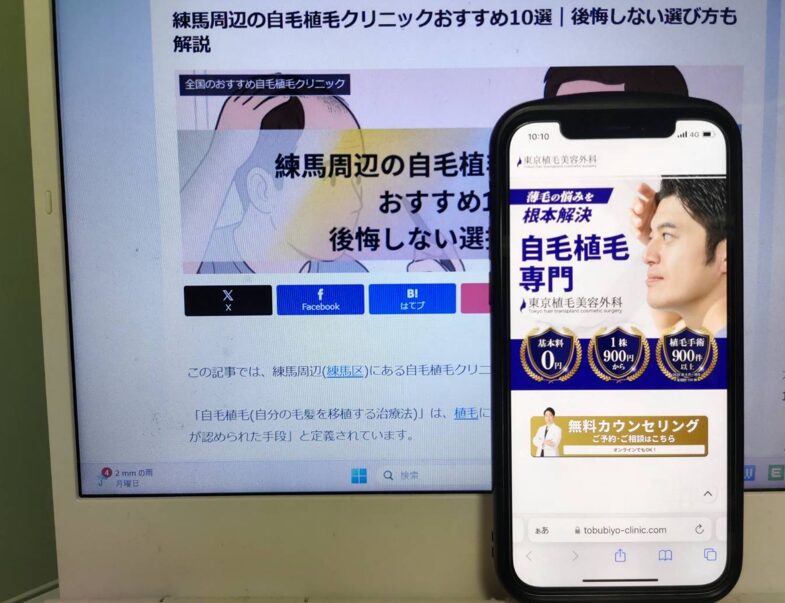 練馬周辺の自毛植毛クリニックおすすめ10選｜後悔しない選び方も解説
