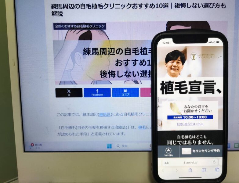 練馬周辺の自毛植毛クリニックおすすめ10選｜後悔しない選び方も解説