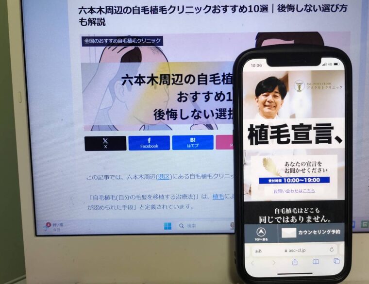六本木周辺の自毛植毛クリニックおすすめ10選｜後悔しない選び方も解説