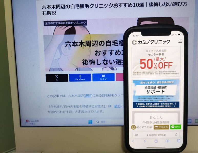 六本木周辺の自毛植毛クリニックおすすめ10選｜後悔しない選び方も解説