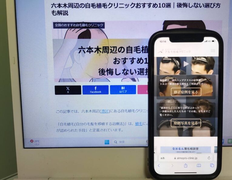 六本木周辺の自毛植毛クリニックおすすめ10選｜後悔しない選び方も解説