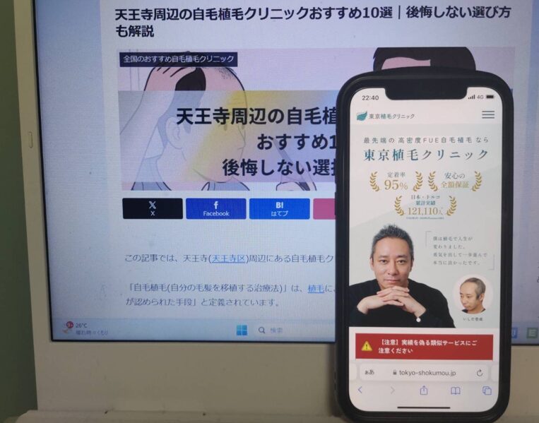 天王寺周辺の自毛植毛クリニックおすすめ10選｜後悔しない選び方も解説