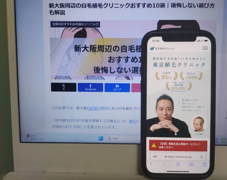 新大阪周辺の自毛植毛クリニックおすすめ10選｜後悔しない選び方も解説