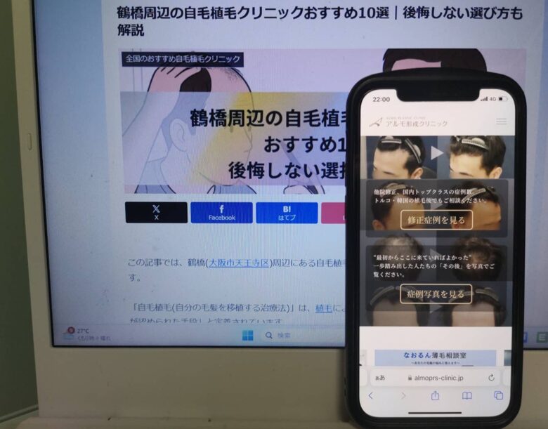 鶴橋周辺の自毛植毛クリニックおすすめ10選｜後悔しない選び方も解説