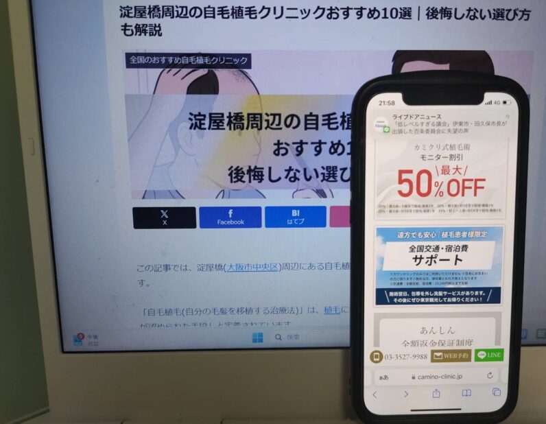 淀屋橋周辺の自毛植毛クリニックおすすめ10選｜後悔しない選び方も解説