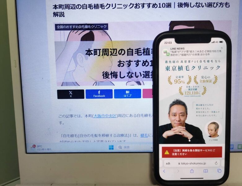 本町周辺の自毛植毛クリニックおすすめ10選｜後悔しない選び方も解説