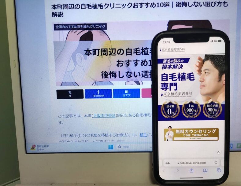 本町周辺の自毛植毛クリニックおすすめ10選｜後悔しない選び方も解説