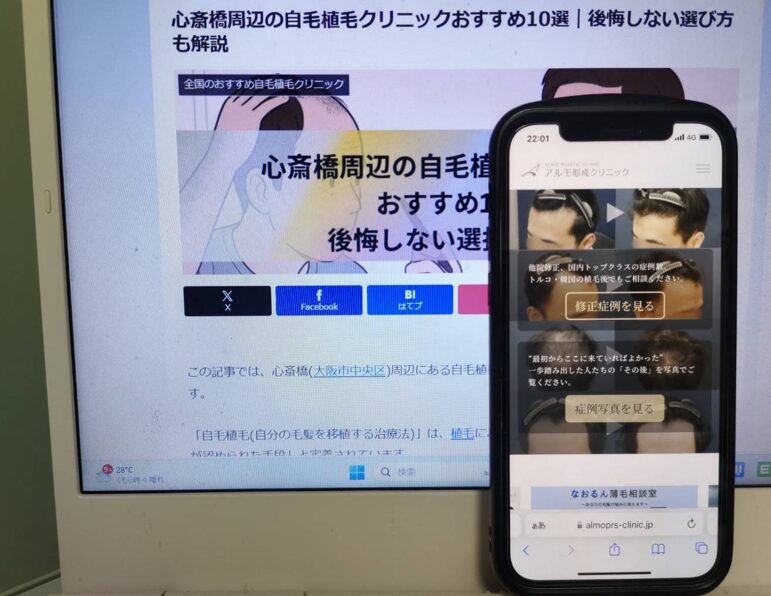 心斎橋周辺の自毛植毛クリニックおすすめ10選|後悔しない選び方も解説
