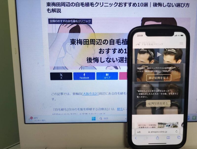 東梅田周辺の自毛植毛クリニックおすすめ10選｜後悔しない選び方も解説