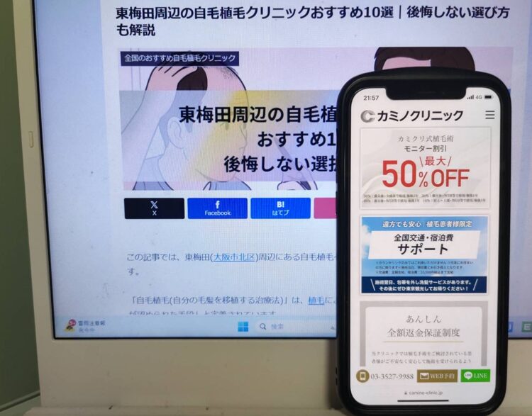 東梅田周辺の自毛植毛クリニックおすすめ10選｜後悔しない選び方も解説