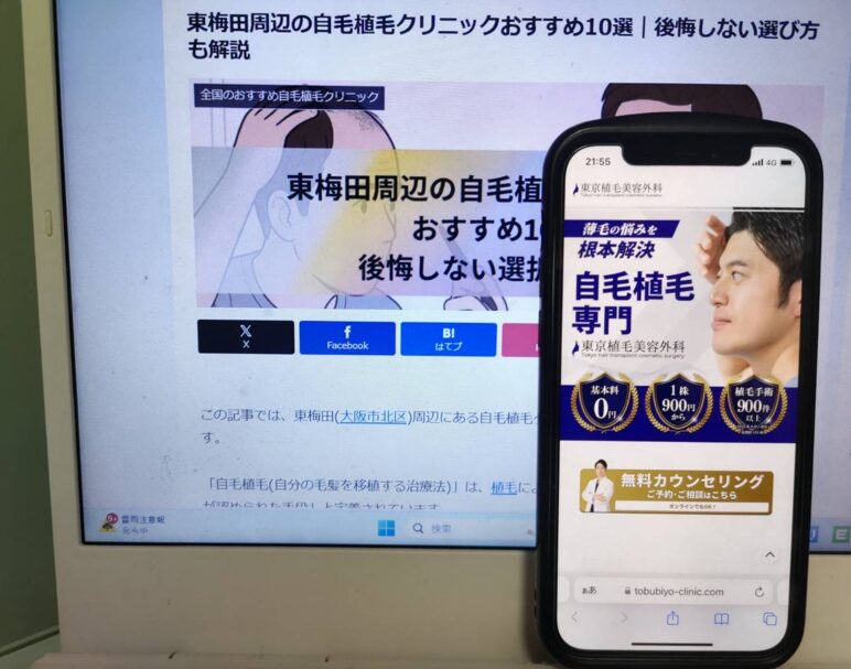 東梅田周辺の自毛植毛クリニックおすすめ10選｜後悔しない選び方も解説