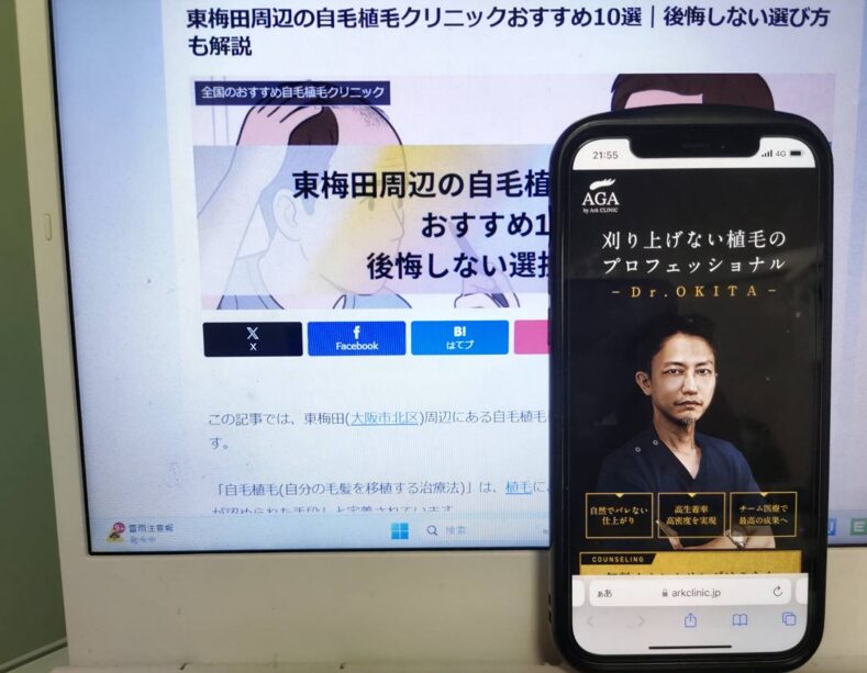 東梅田周辺の自毛植毛クリニックおすすめ10選｜後悔しない選び方も解説