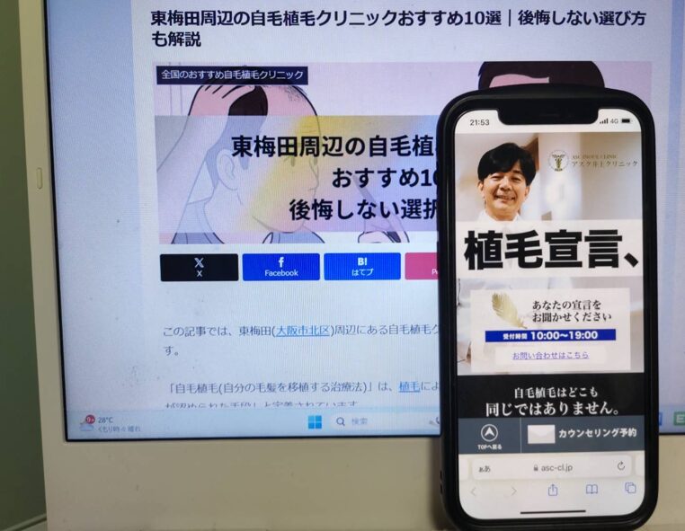 東梅田周辺の自毛植毛クリニックおすすめ10選｜後悔しない選び方も解説