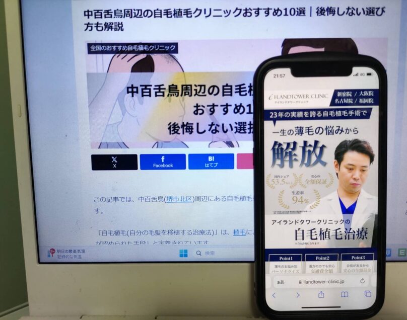 中百舌鳥周辺の自毛植毛クリニックおすすめ10選｜後悔しない選び方も解説