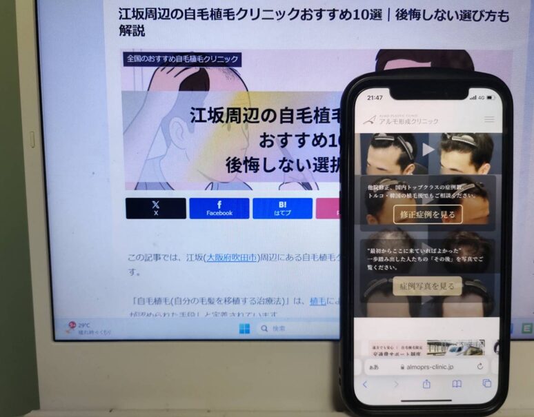 江坂周辺の自毛植毛クリニックおすすめ10選｜後悔しない選び方も解説