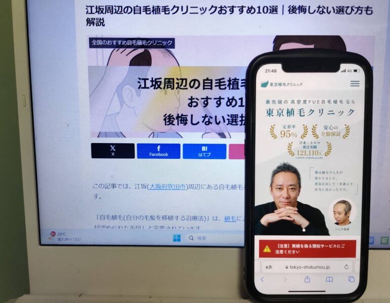 江坂周辺の自毛植毛クリニックおすすめ10選｜後悔しない選び方も解説