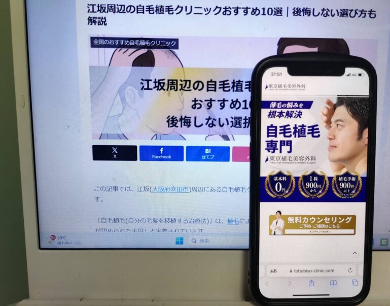 江坂周辺の自毛植毛クリニックおすすめ10選｜後悔しない選び方も解説