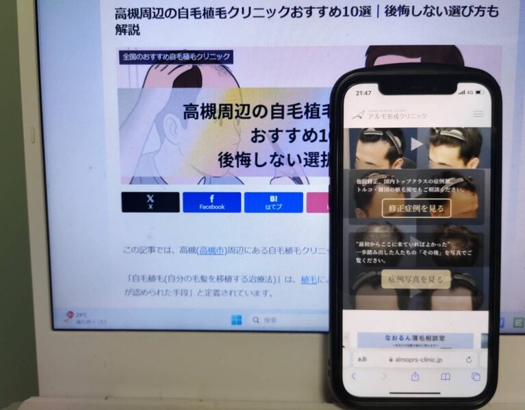 高槻周辺の自毛植毛クリニックおすすめ10選｜後悔しない選び方も解説