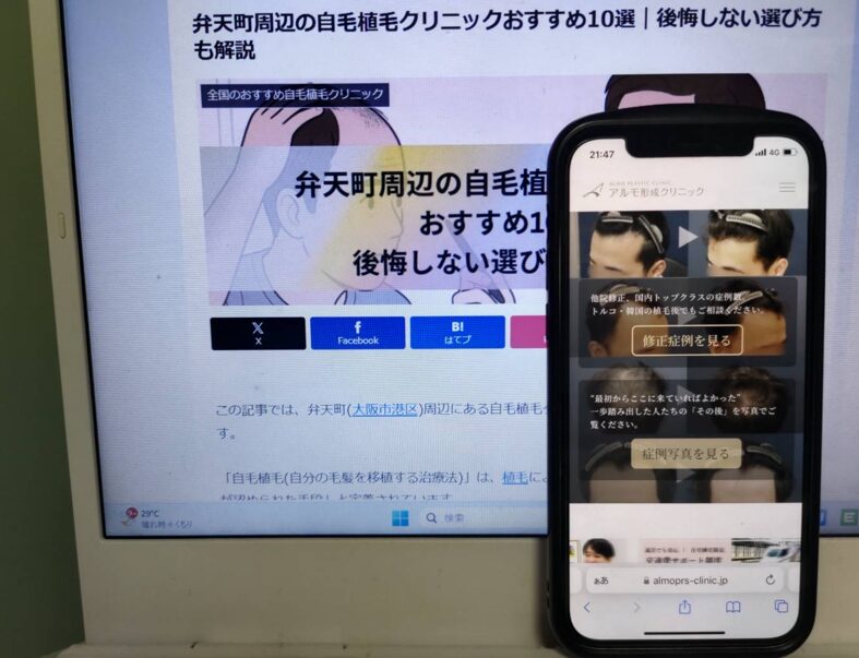 弁天町周辺の自毛植毛クリニックおすすめ10選｜後悔しない選び方も解説