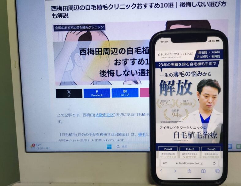西梅田周辺の自毛植毛クリニックおすすめ10選｜後悔しない選び方も解説