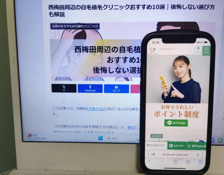 西梅田周辺の自毛植毛クリニックおすすめ10選｜後悔しない選び方も解説