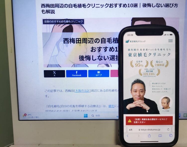 西梅田周辺の自毛植毛クリニックおすすめ10選｜後悔しない選び方も解説