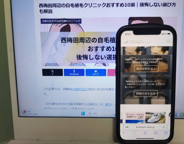 西梅田周辺の自毛植毛クリニックおすすめ10選｜後悔しない選び方も解説