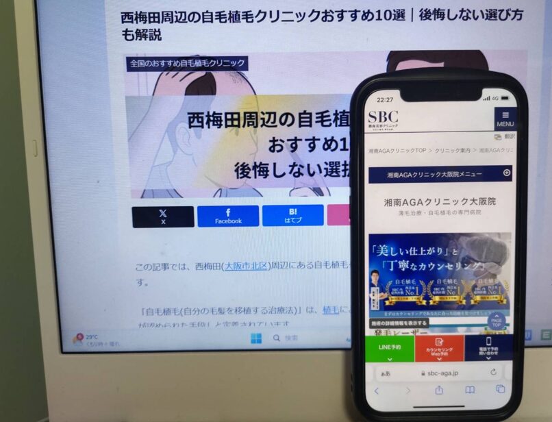 西梅田周辺の自毛植毛クリニックおすすめ10選｜後悔しない選び方も解説
