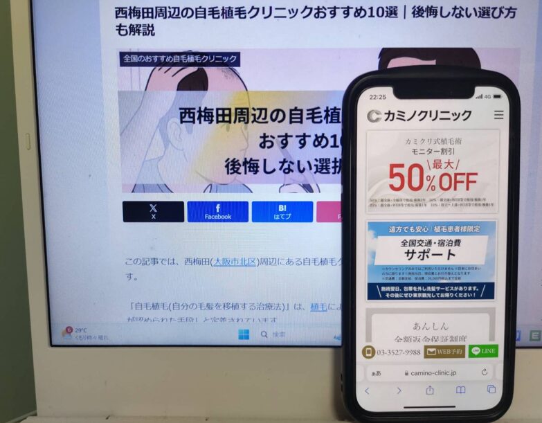 西梅田周辺の自毛植毛クリニックおすすめ10選｜後悔しない選び方も解説