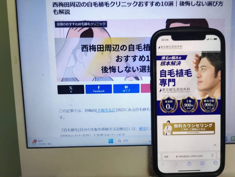 西梅田周辺の自毛植毛クリニックおすすめ10選｜後悔しない選び方も解説