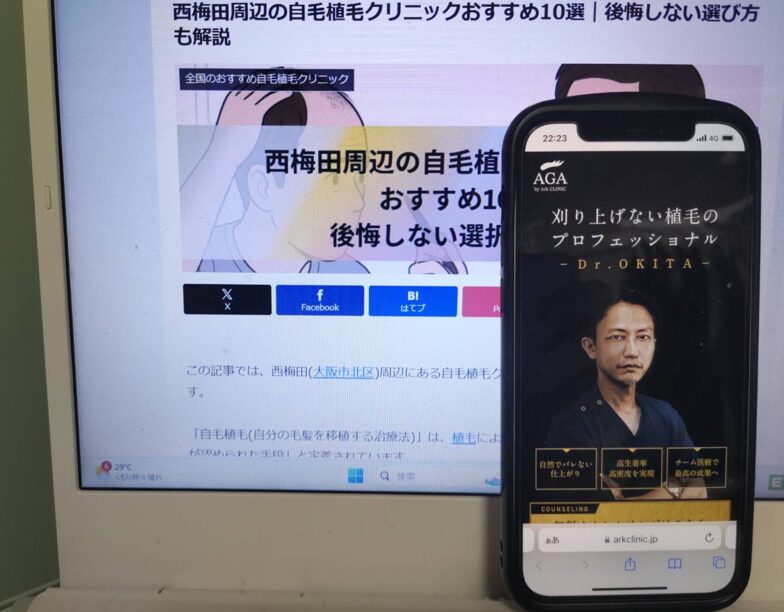 西梅田周辺の自毛植毛クリニックおすすめ10選｜後悔しない選び方も解説