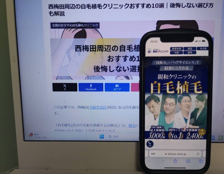 西梅田周辺の自毛植毛クリニックおすすめ10選｜後悔しない選び方も解説