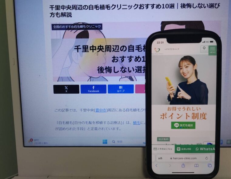 千里中央周辺の自毛植毛クリニックおすすめ10選｜後悔しない選び方も解説