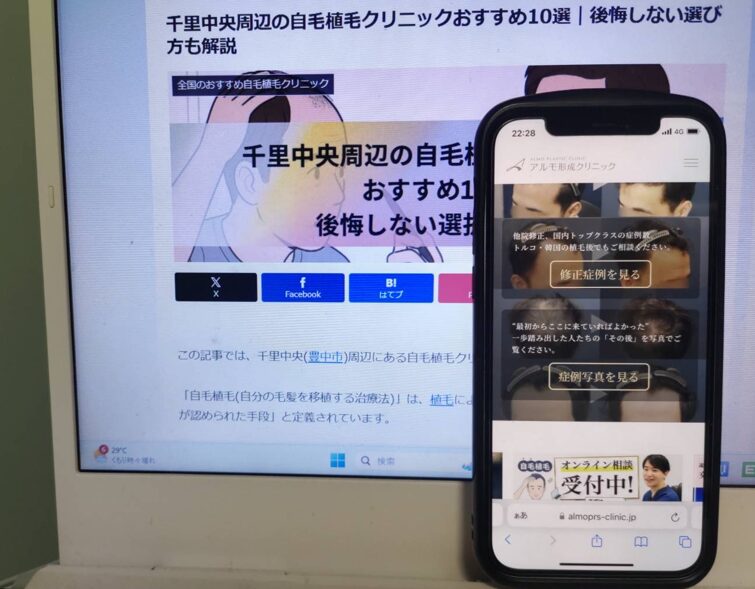 千里中央周辺の自毛植毛クリニックおすすめ10選｜後悔しない選び方も解説
