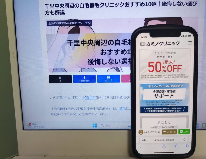千里中央周辺の自毛植毛クリニックおすすめ10選｜後悔しない選び方も解説
