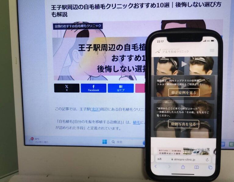王子駅周辺の自毛植毛クリニックおすすめ10選｜後悔しない選び方も解説