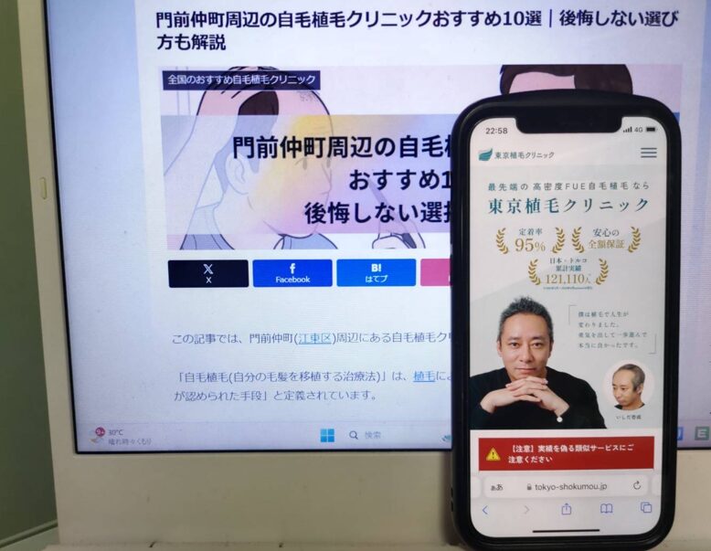 門前仲町周辺の自毛植毛クリニックおすすめ10選|後悔しない選び方も解説