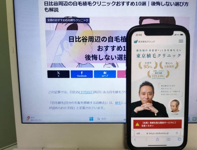 日比谷周辺の自毛植毛クリニックおすすめ10選｜後悔しない選び方も解説