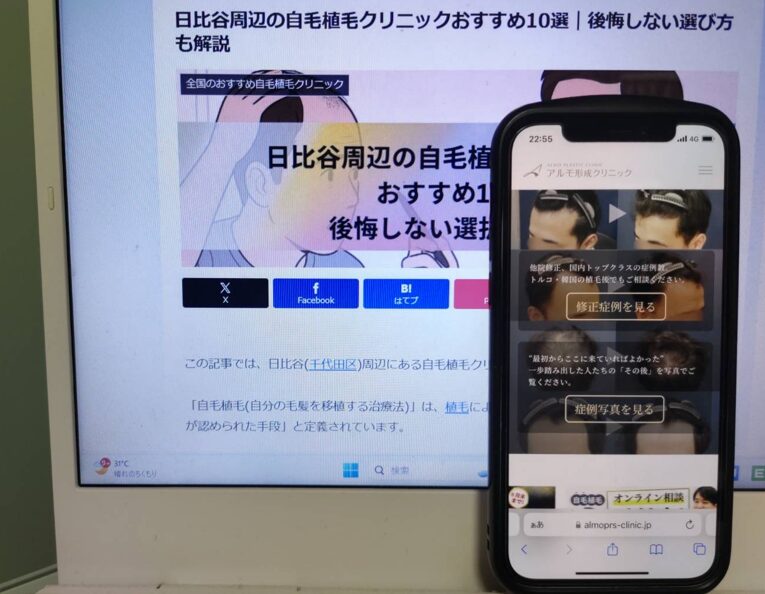 日比谷周辺の自毛植毛クリニックおすすめ10選｜後悔しない選び方も解説